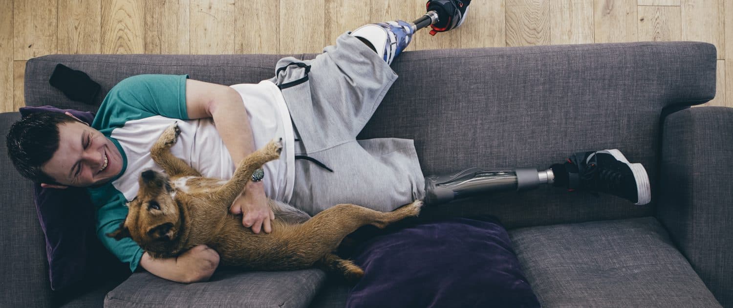 Amputee and his Dog